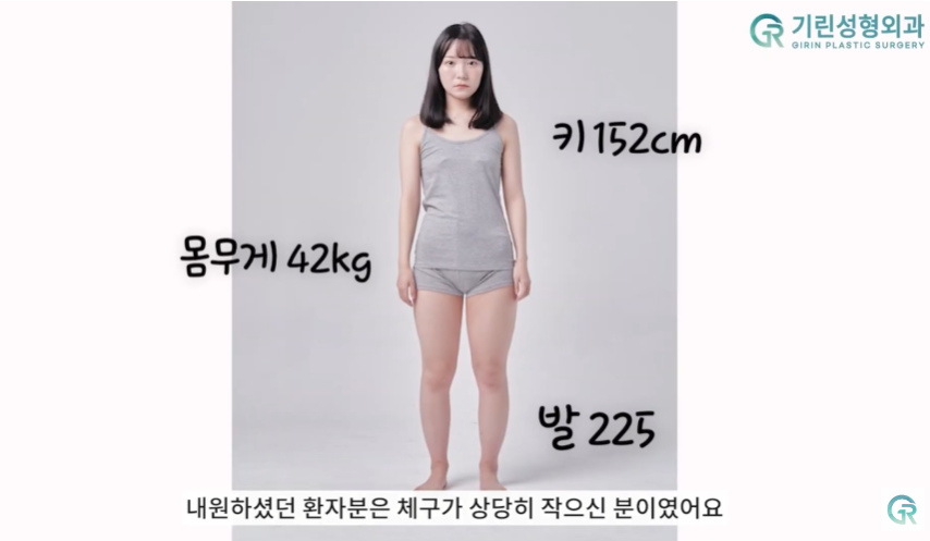 [기린성형외과의원] 뼈벅지?허틈!_허벅지지방흡입 수술일지 관련 이미지 3