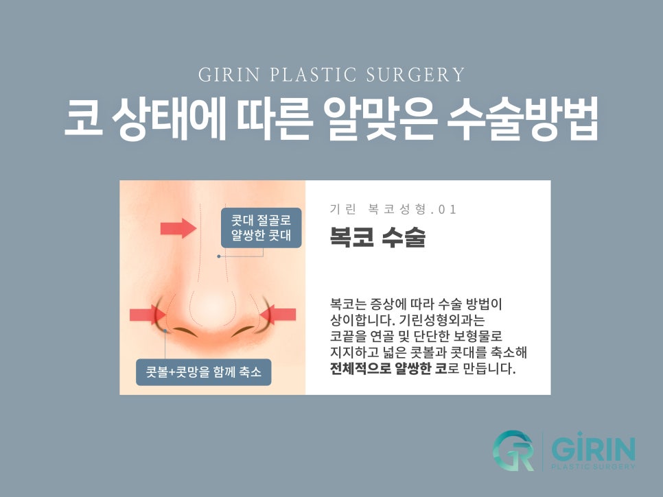 서울코성형 신중하게 정해야 관련 이미지 10