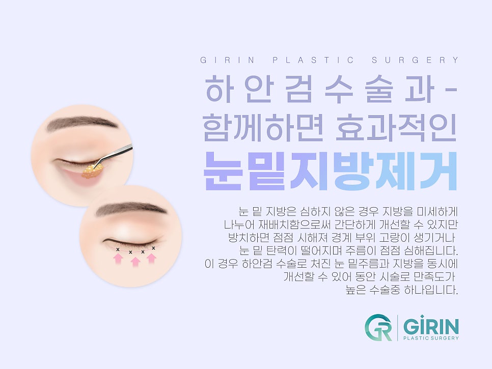 하안검수술잘하는곳 주름이 고민이라면 관련 이미지 9
