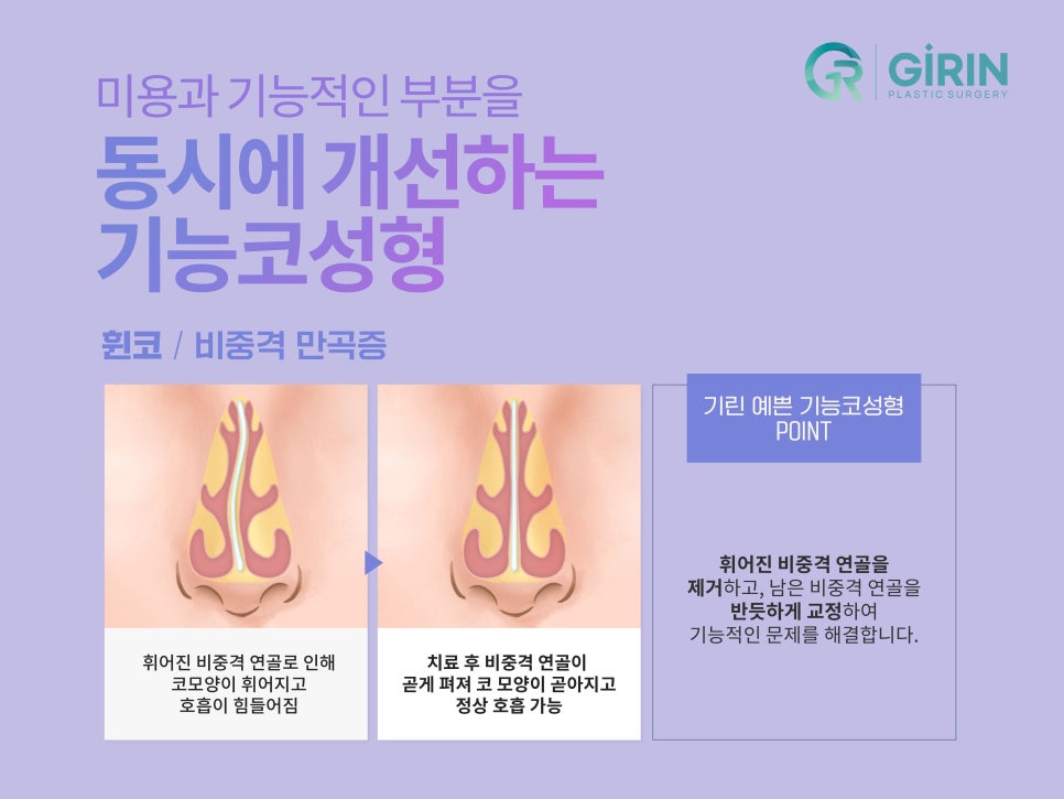 강남코수술잘하는곳 궁금했다면 관련 이미지 4