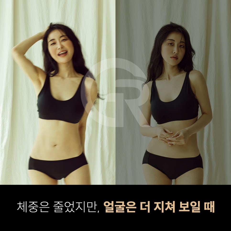 위고비&middot;마운자로 후 얼굴처짐으로 인한 미니거상 후기 관련 이미지 1