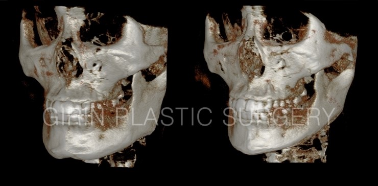 뉴브이라인 6주차 관련 이미지 3