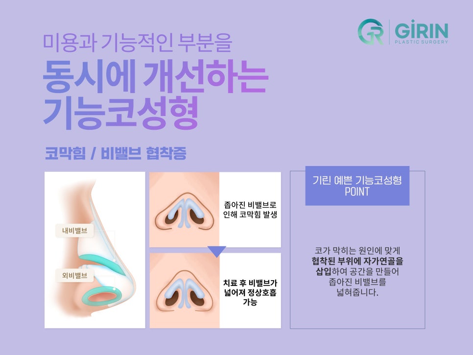 강남코수술잘하는곳 궁금했다면 관련 이미지 5