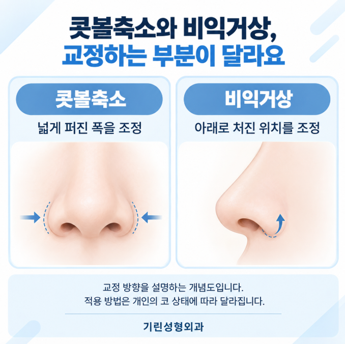 비익거상, 코수술할 때 처진 콧볼을 함께 보는 이유 관련 이미지 5