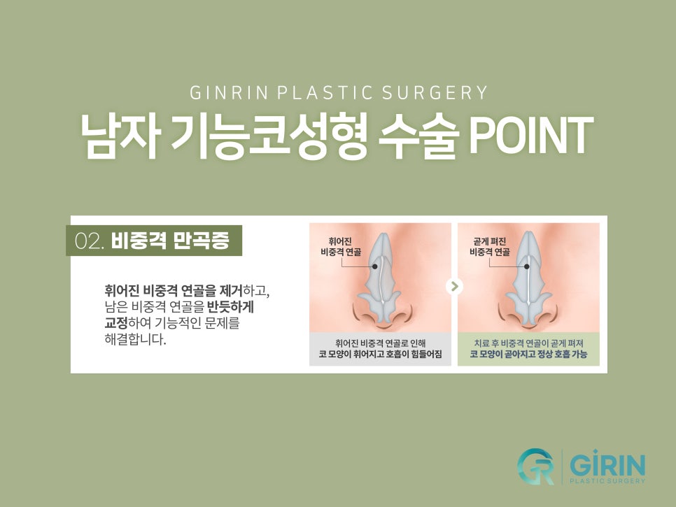 남자코성형잘하는곳 자연스러운 모습은 관련 이미지 8