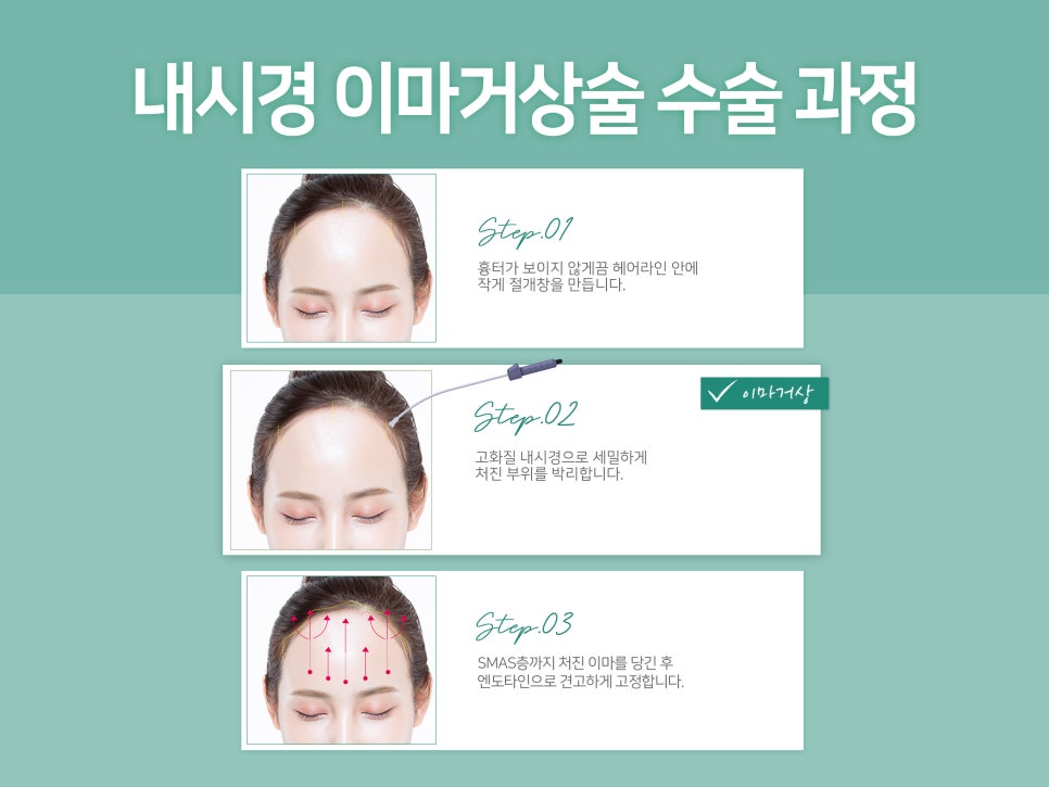 이마거상술효과 확실히 보려면 관련 이미지 6