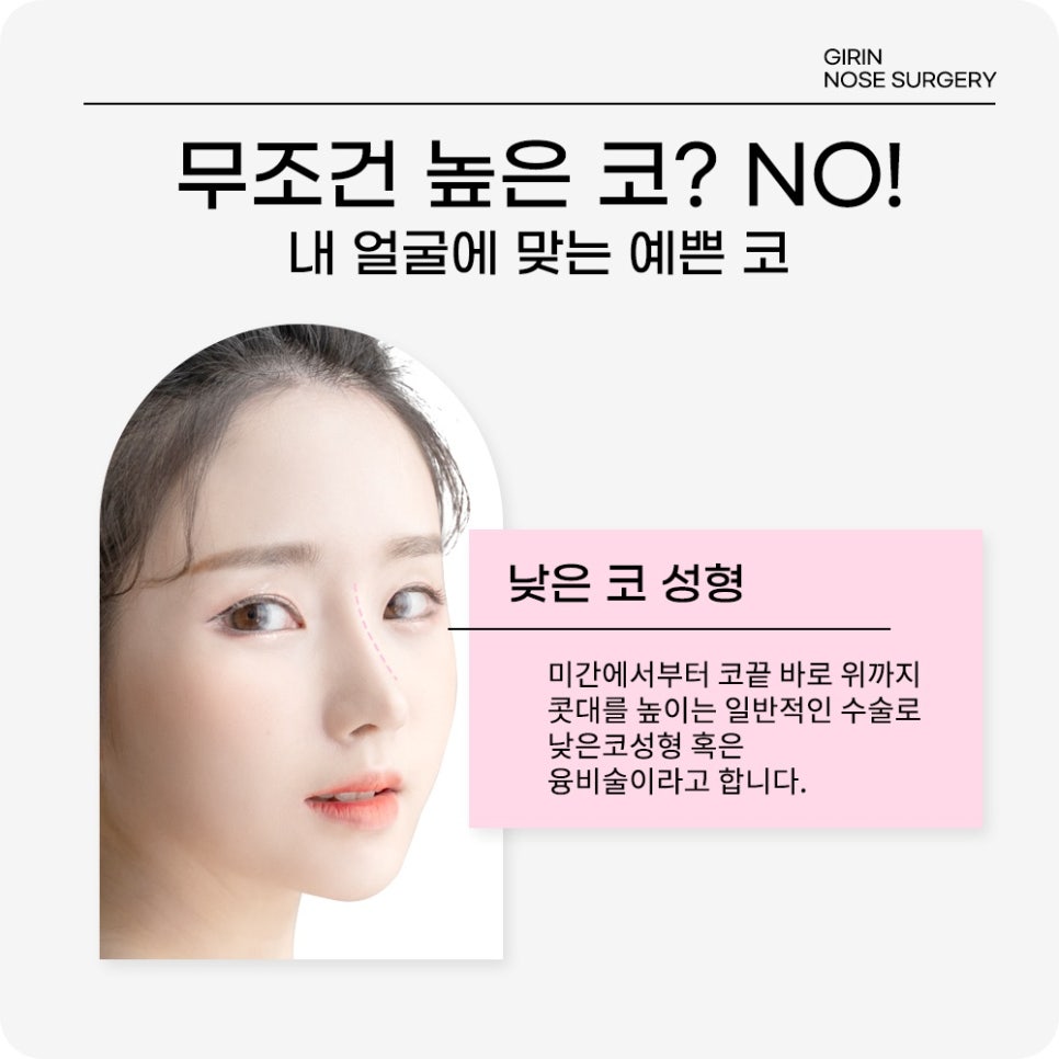 코성형잘하는곳? 강남 기린성형외과를 찾는 이유는 OOO이다 관련 이미지 6