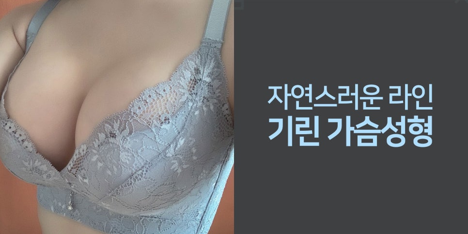 모티바가슴성형후기 신중하게 살펴보고 관련 이미지 2