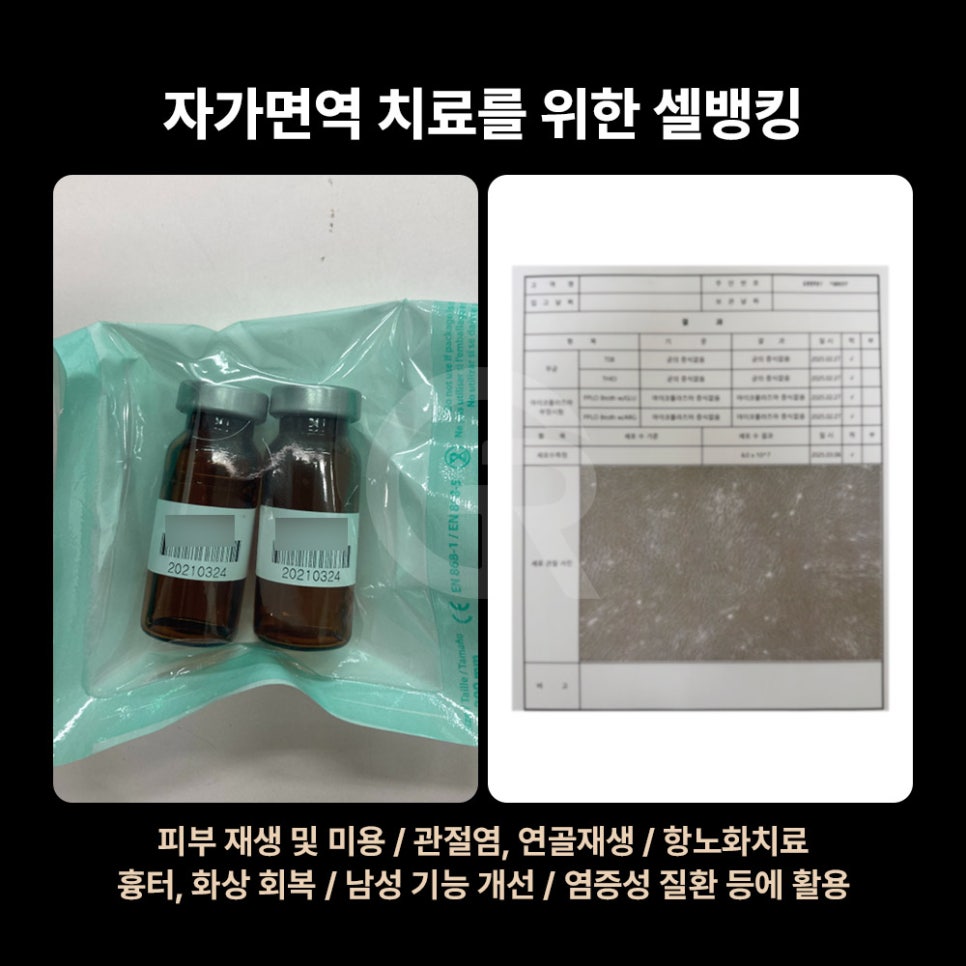 셀뱅킹, 줄기세포 전문 기린성형외과가 제안하는 미래 건강 관리 관련 이미지 6