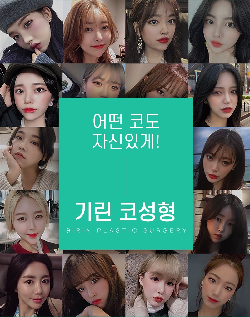 코성형수술비용 확실한 기준으로 정확하게 관련 이미지 6