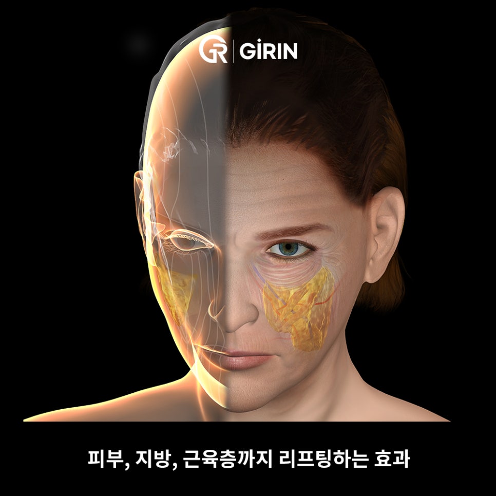 안면거상 비용, 왜 이렇게 차이 날까? 관련 이미지 10