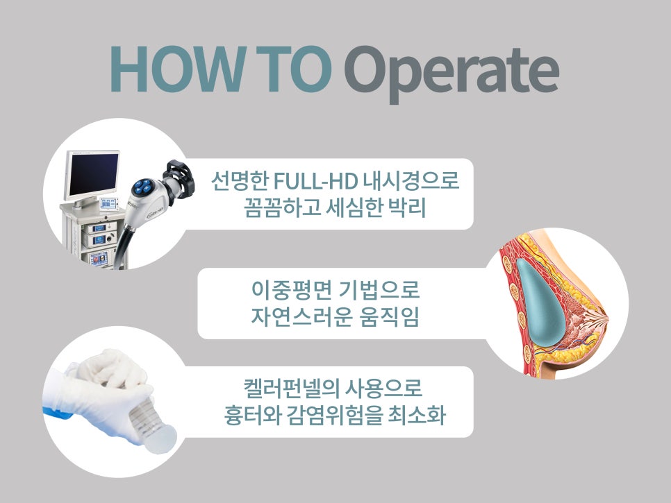 가슴성형종류 알고 선택해야 관련 이미지 11