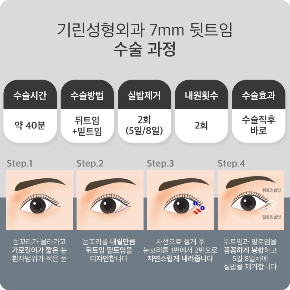 쌍수가격? 의미 없는 이유 관련 이미지 7