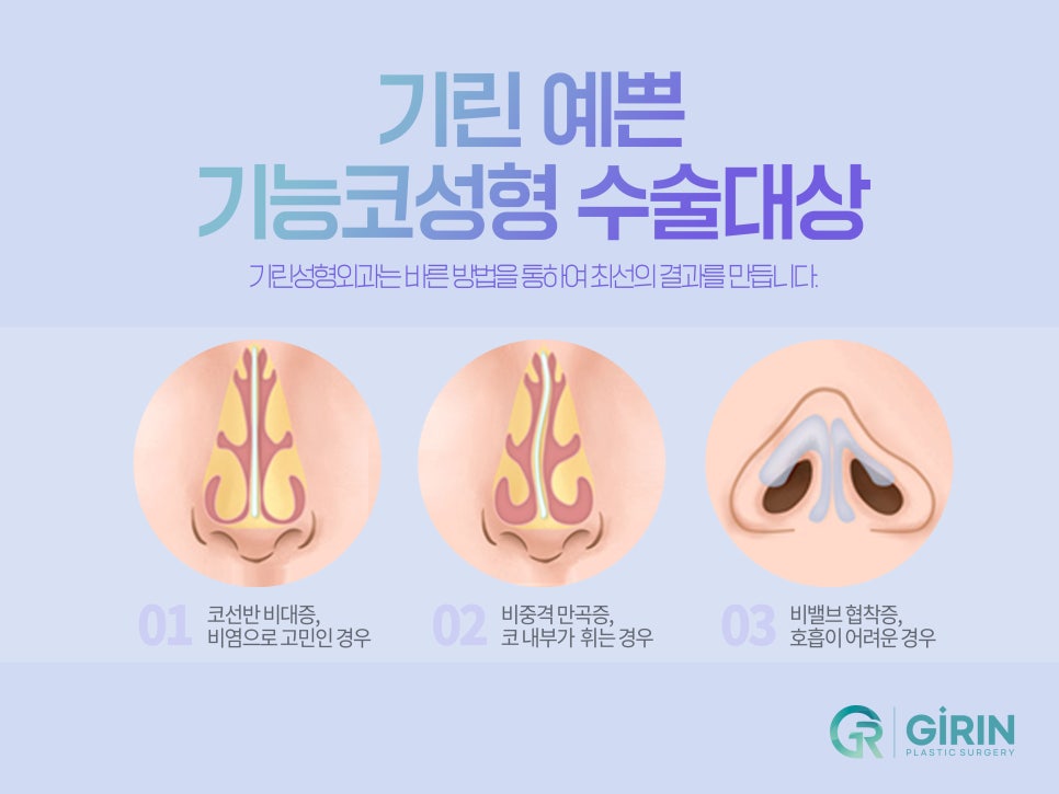 기능성 코성형 원인 찾아 해결하며 관련 이미지 4