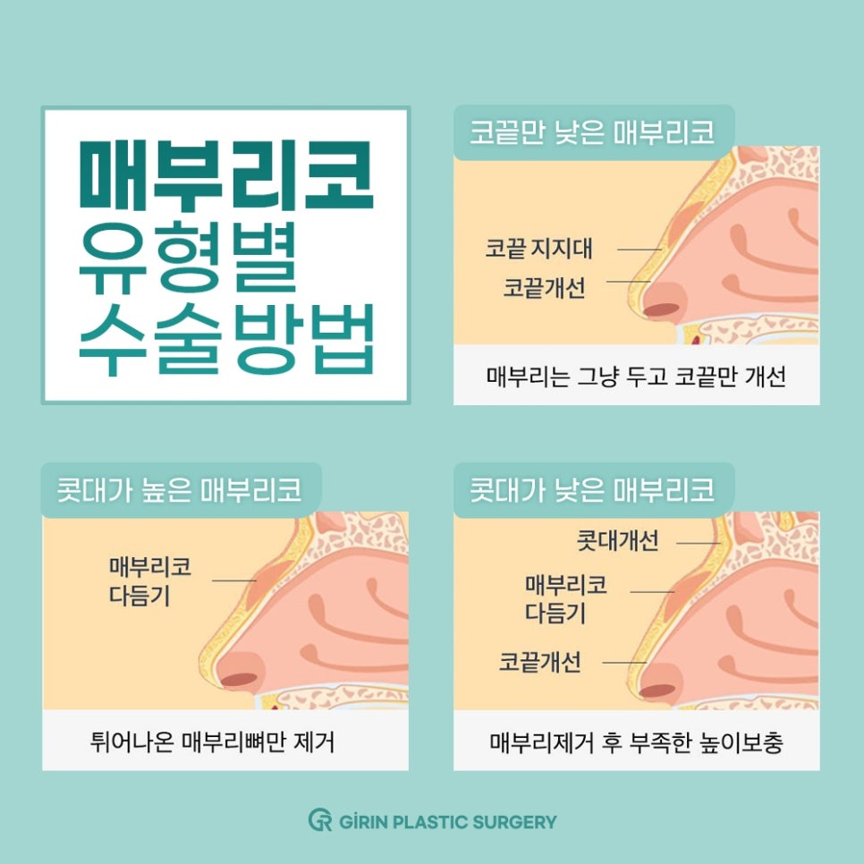 콧대높이기? 관련 이미지 8