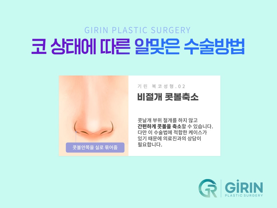 콧볼축소술 뭉툭한 코 개선을 위해 관련 이미지 6