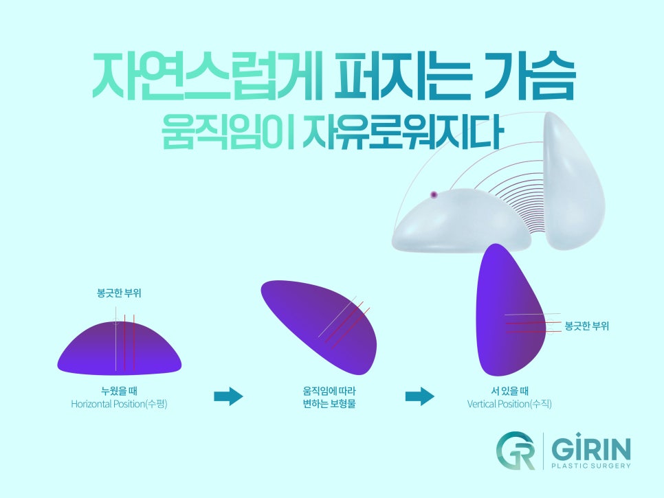 가슴성형외과유명한곳 확실하게 알아보고 관련 이미지 11