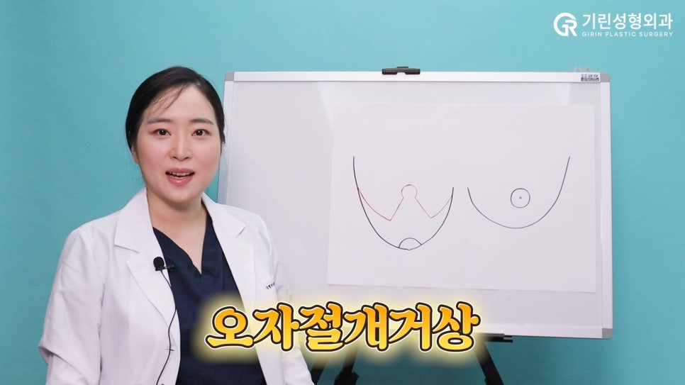 [기린성형외과]가슴거상_처진가슴 자가 진단법 및 수술법 관련 이미지 8