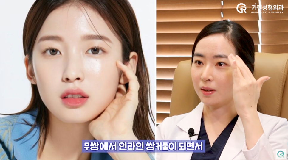 [기린성형외과의원] 무쌍 여자 아이돌의 매력포인트_성형외과 전문의 얼굴분석 관련 이미지 13