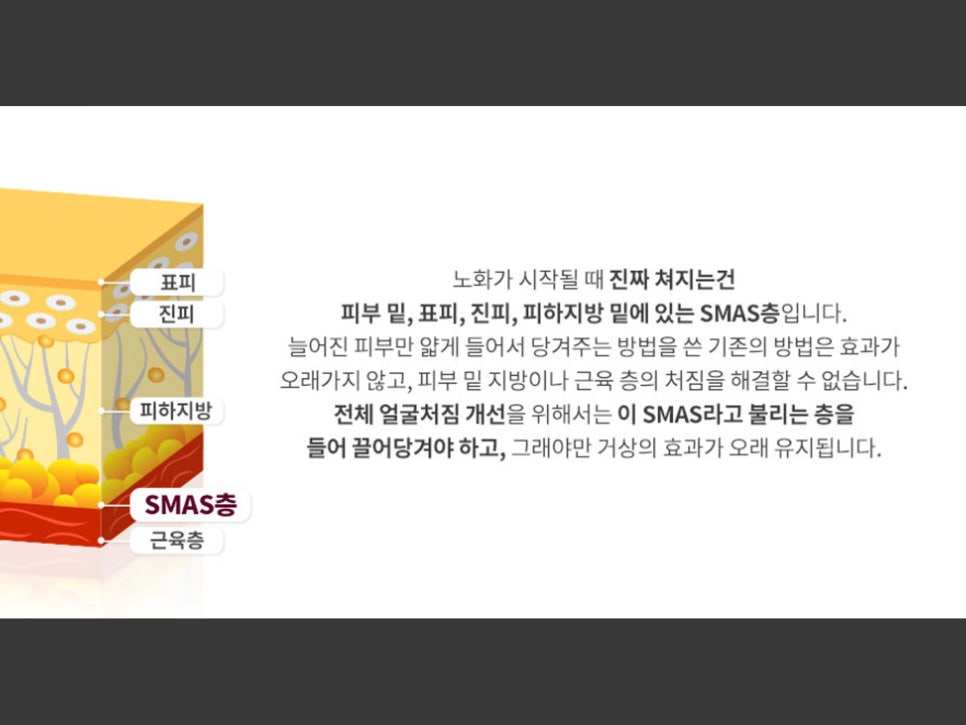 안면거상수술 효과 확실하려면 관련 이미지 10