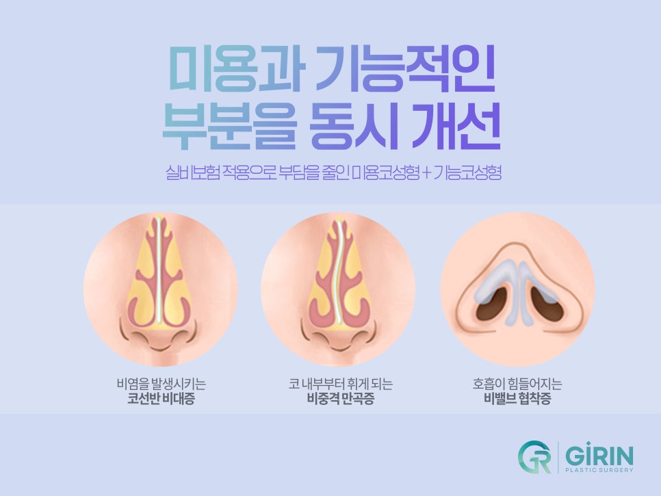 기능성 코성형 원인 찾아 해결하며 관련 이미지 3