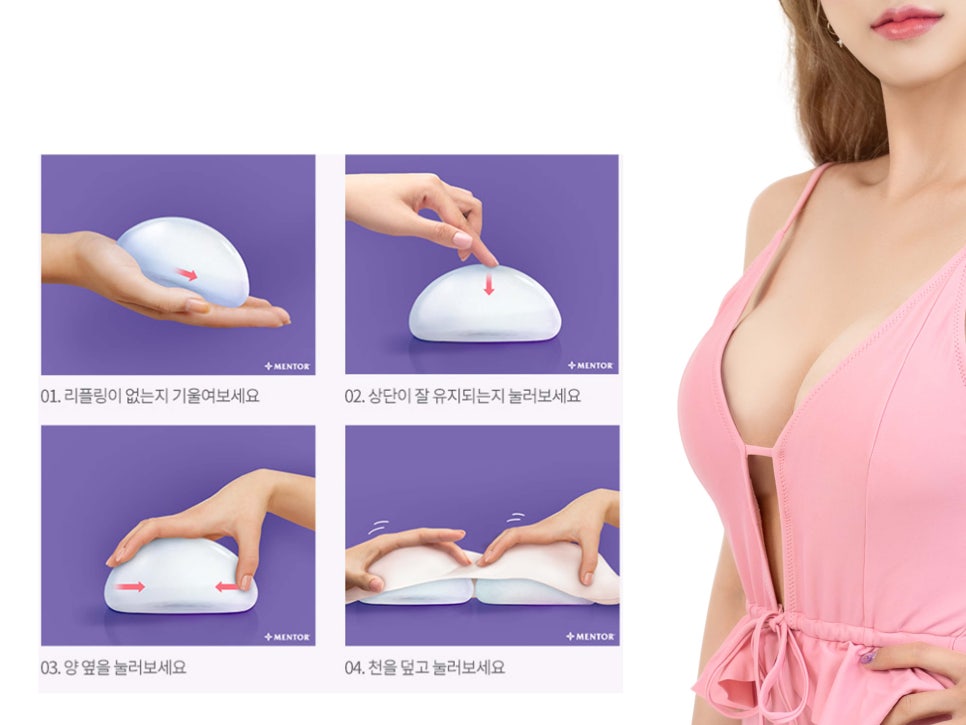 멘토가슴성형 차이를 알고 선택해야 관련 이미지 7