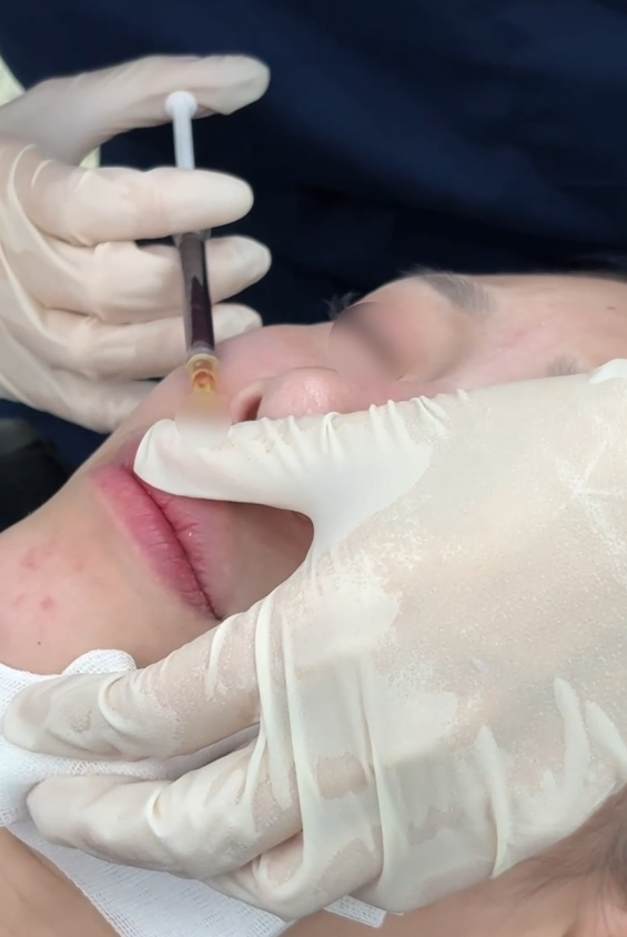 일요일에도 리프팅 가능한 이유 기린성형외과 관련 이미지 12