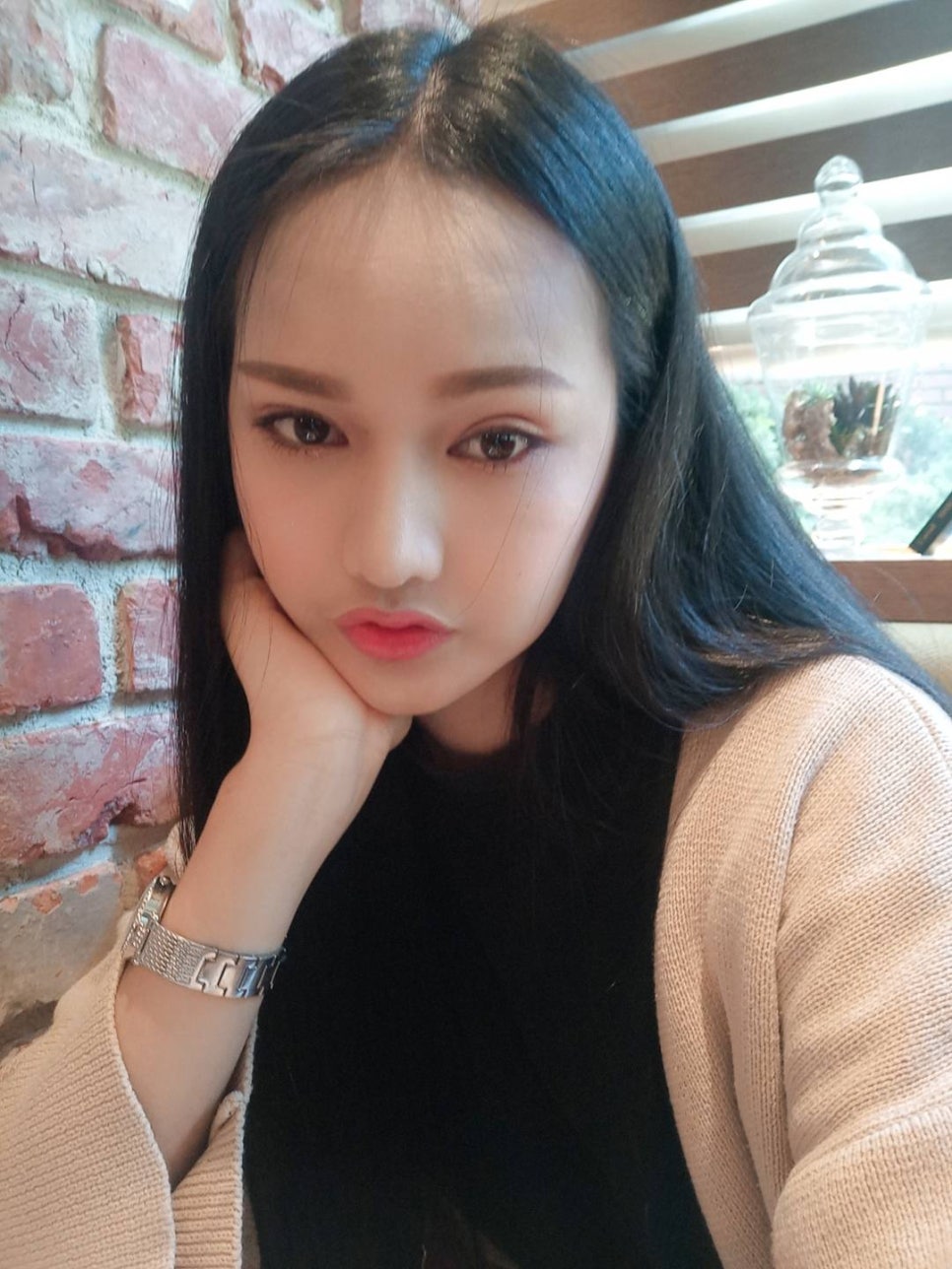 [사각턱축소 최다수술 이승룡원장] 태국에서 온 그녀의 윤곽 수술 후기 리얼 스토리&hearts; 관련 이미지 9