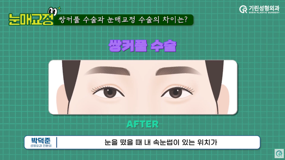 [기린성형외과의원]_눈매교정과 첫인상의 중요성 관련 이미지 3