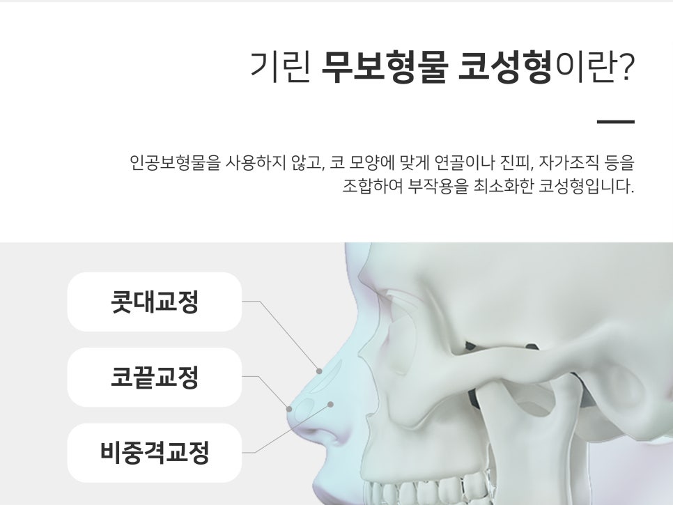 복코수술전후 이미지가 달라지는 관련 이미지 8