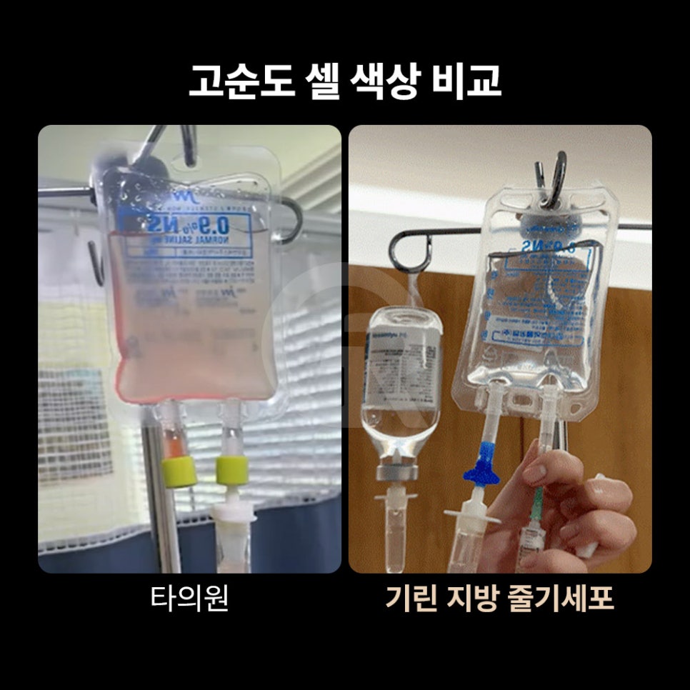 셀뱅킹, 줄기세포 전문 기린성형외과가 제안하는 미래 건강 관리 관련 이미지 1