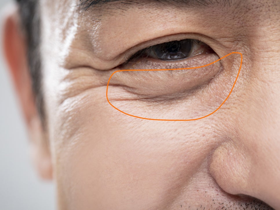 중년눈성형 우아하게 잡아주며 관련 이미지 8