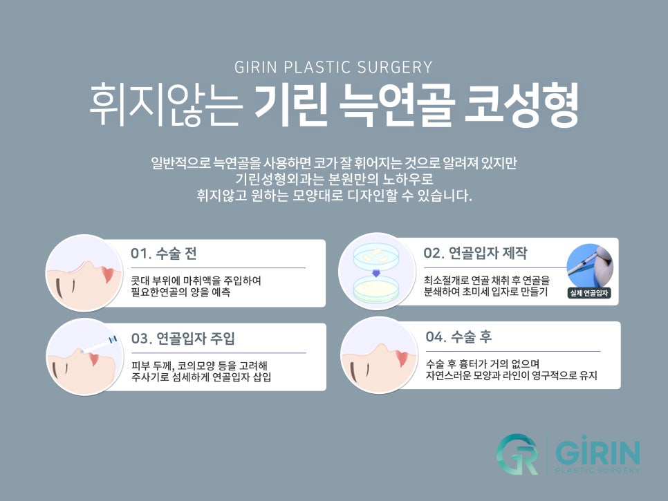 서울코성형 신중하게 정해야 관련 이미지 7