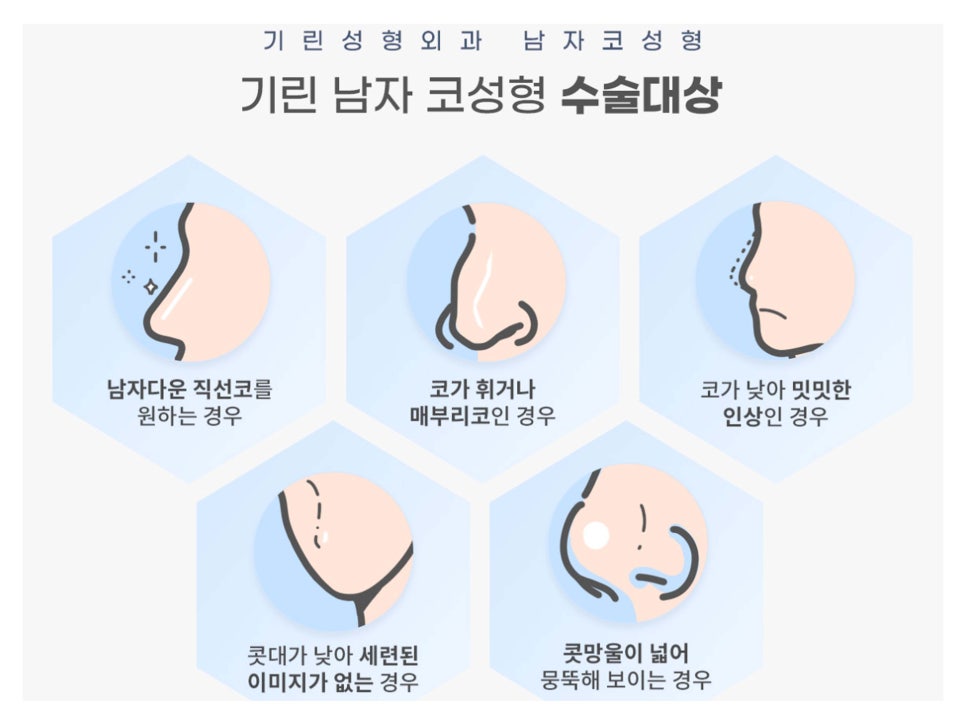 남자코수술전후 주의해서 선택을 관련 이미지 7