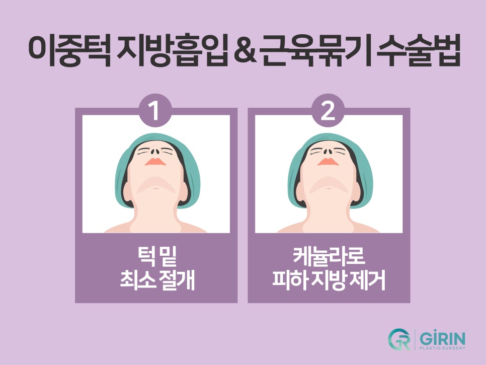 강남이중턱지방흡입 체크할 것 관련 이미지 11