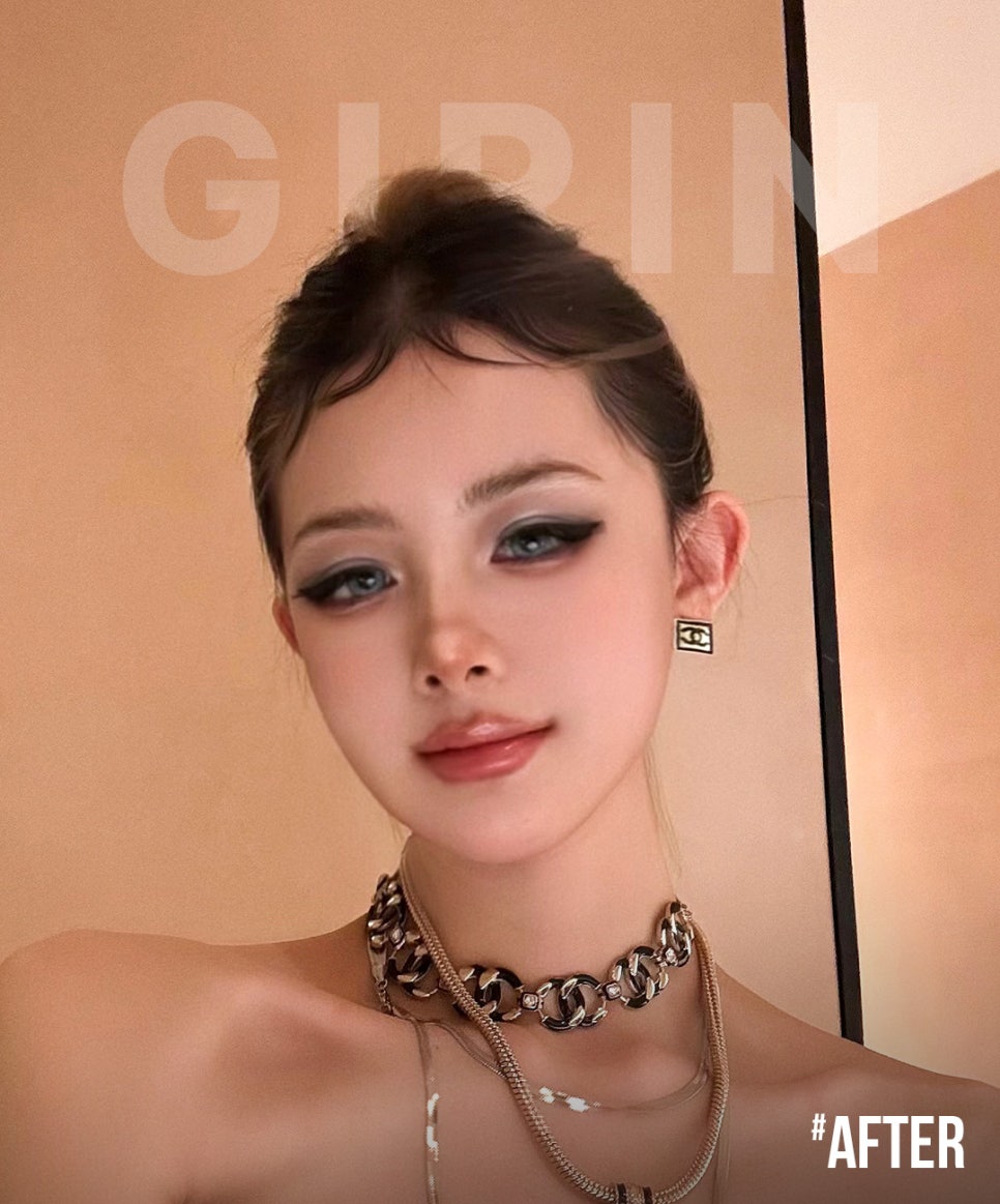 기린 성형외과는 광대축소술을 어떻게 진행하나요? 관련 이미지 4