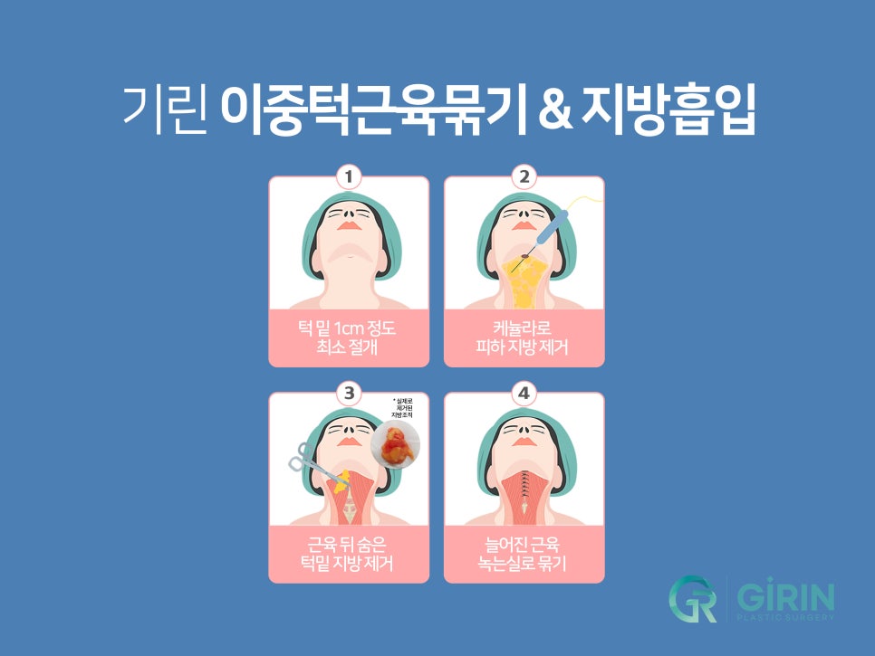 이중턱근육묶기 탄력 저하 잡아주는 관련 이미지 5