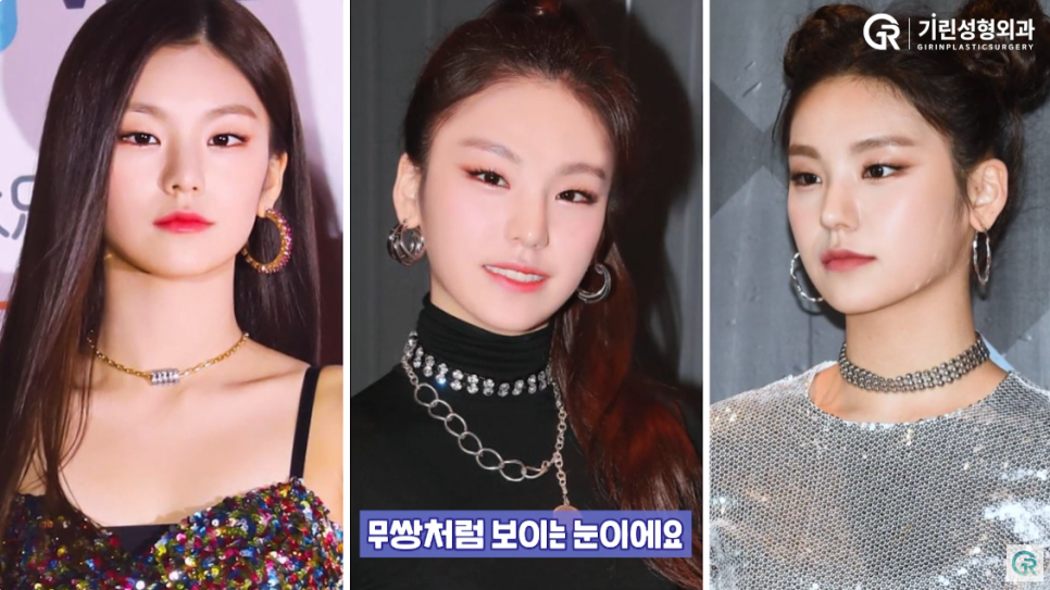 [기린성형외과의원] 무쌍 여자 아이돌의 매력포인트_성형외과 전문의 얼굴분석 관련 이미지 7