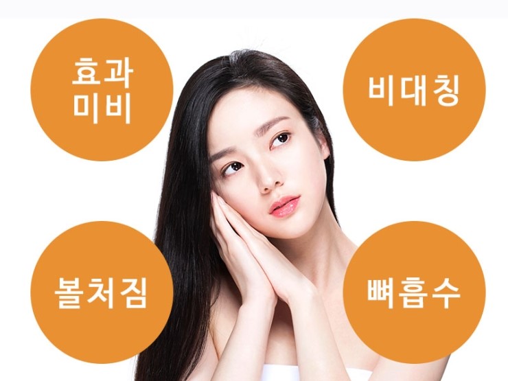 안면윤곽재수술 시 고려해야 할 점 관련 이미지 8