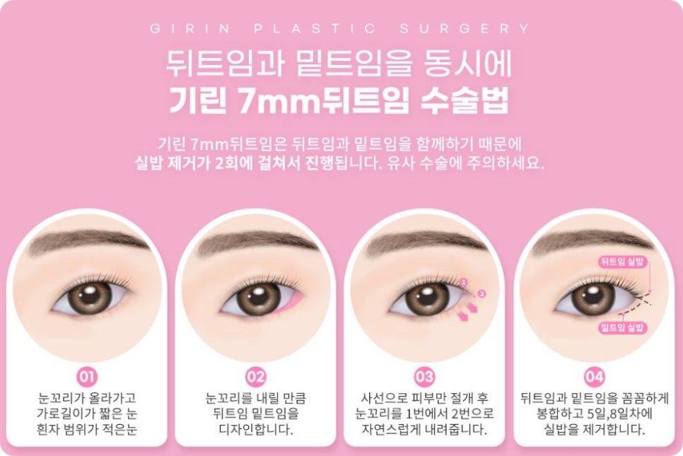 쌍수가격? 의미 없는 이유 관련 이미지 8