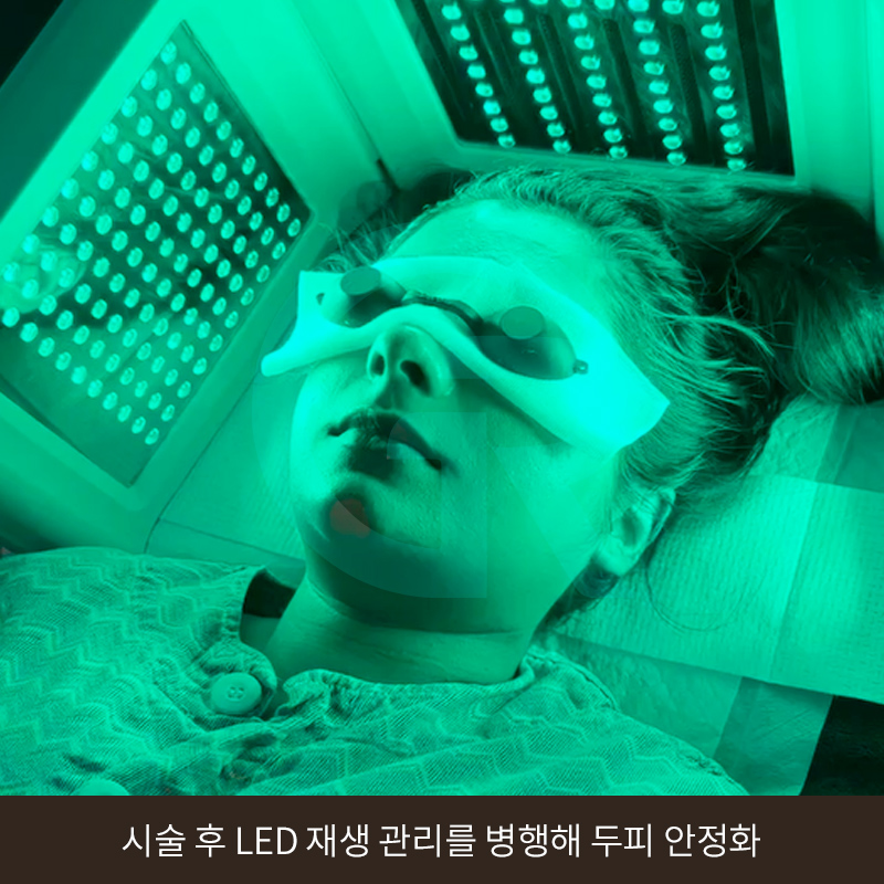 탈모 고민 두피 줄기세포 치료, 가격이 다른 이유는? 관련 이미지 12