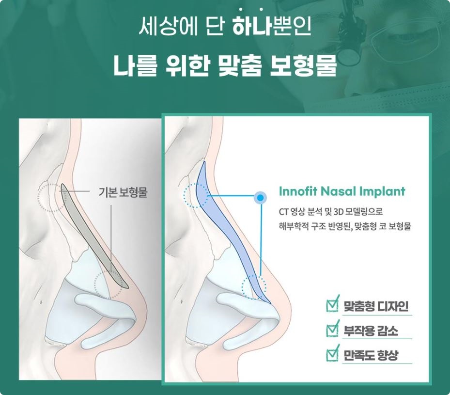 자가연골코성형, 제대로 따져보고 해야 하는 이유 관련 이미지 5