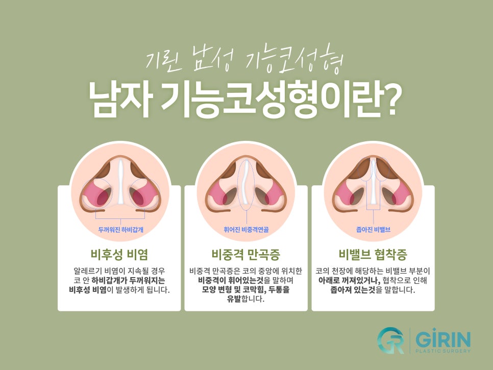 남자코성형잘하는곳 자연스러운 모습은 관련 이미지 5