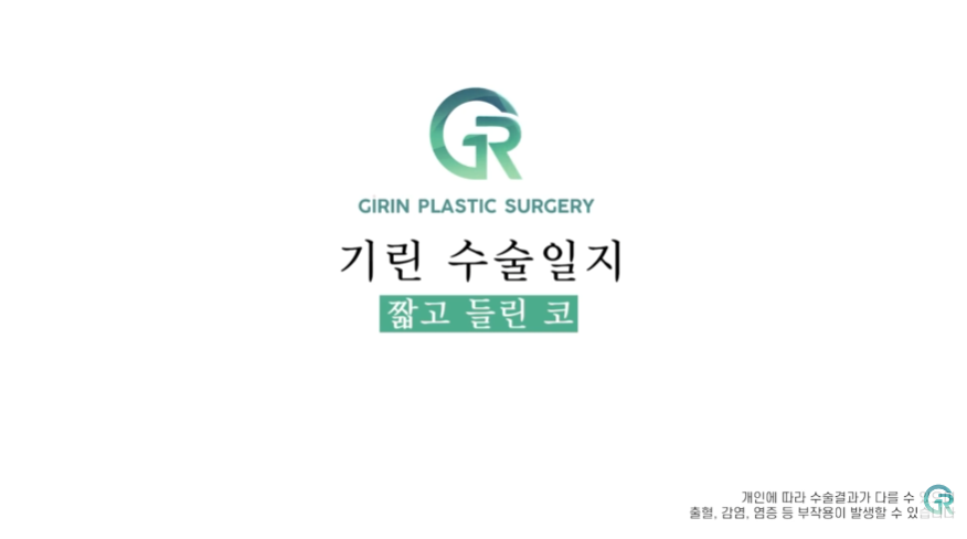[기린성형외과] 짧고, 들린 코 탈출!_코성형 수술일지 관련 이미지 1
