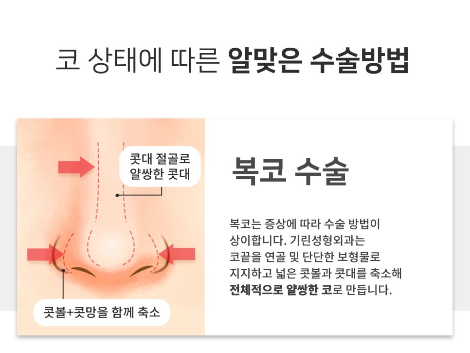 복코수술전후 이미지가 달라지는 관련 이미지 4