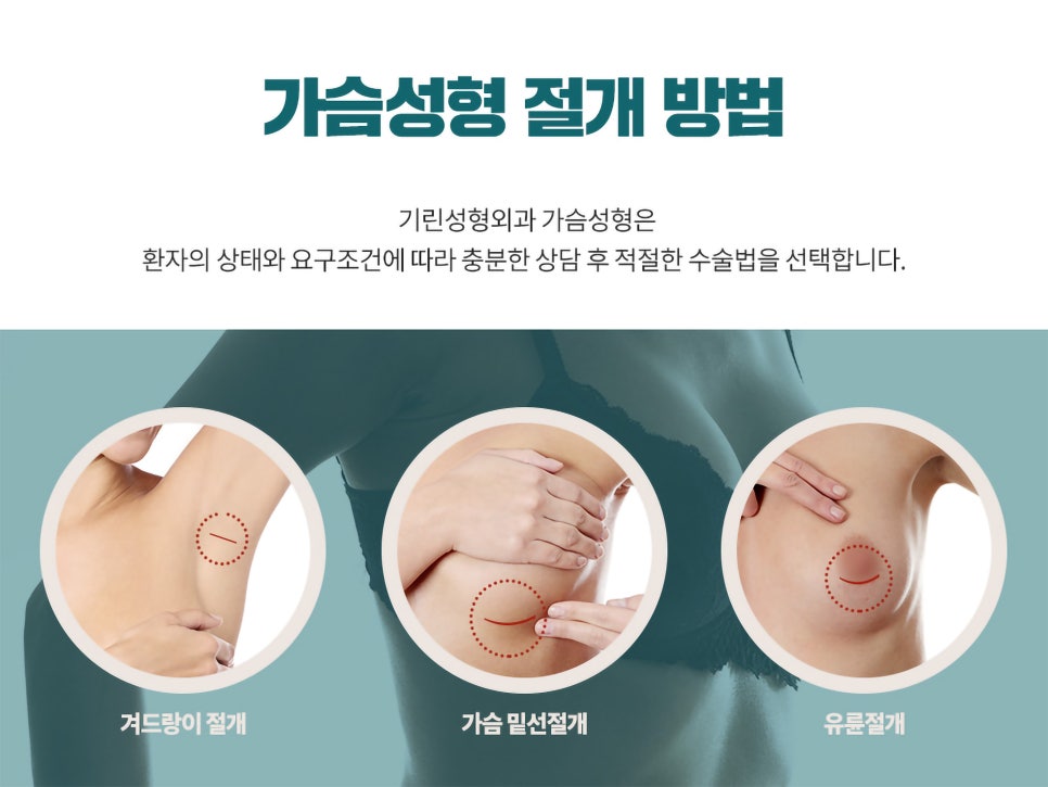 가슴확대수술후기 맞춤으로 알아봐야 관련 이미지 5