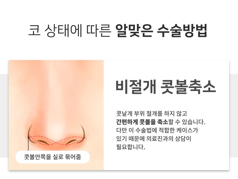 복코수술전후 이미지가 달라지는 관련 이미지 6
