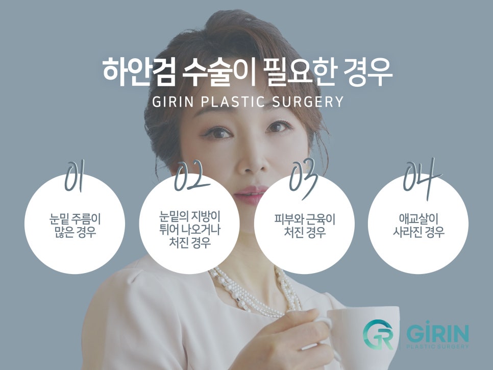 중년눈성형잘하는곳 찾았다면 관련 이미지 7