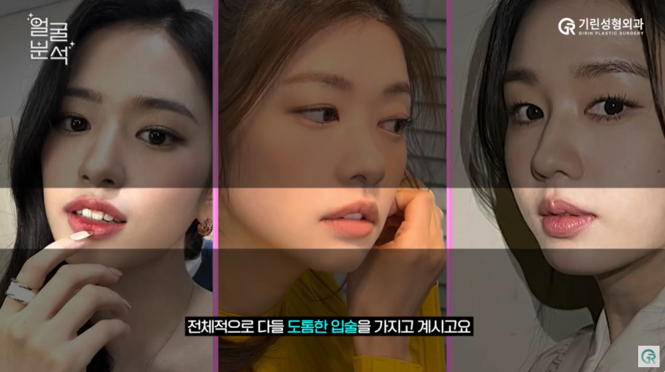[기린성형외과의원]_자매 아닌가요? 안유진, 정소민, 안은진 얼굴분석 관련 이미지 10