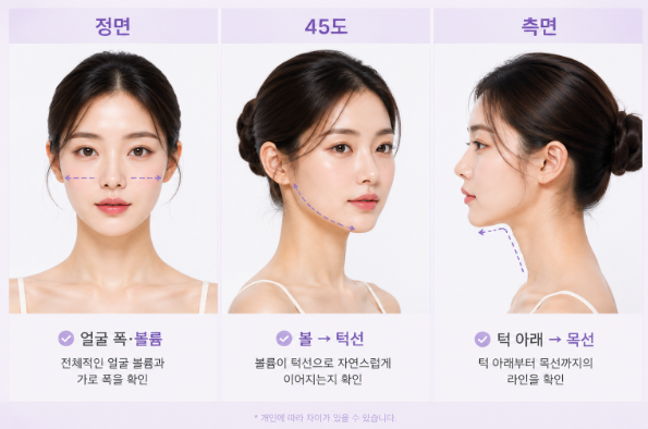 갸름주사 몇 번 받아야 할까요? 횟수와 주기 알아보기 관련 이미지 5